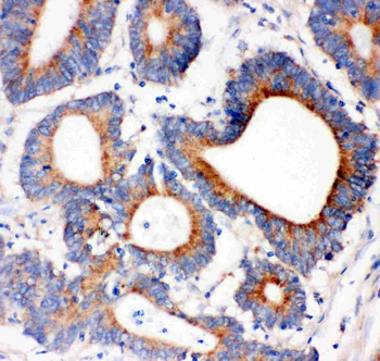 IRS1 Rabbit Polyclonal Antibody