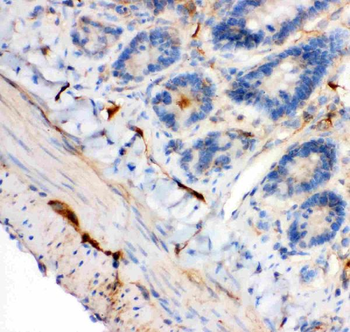 IRS1 Rabbit Polyclonal Antibody