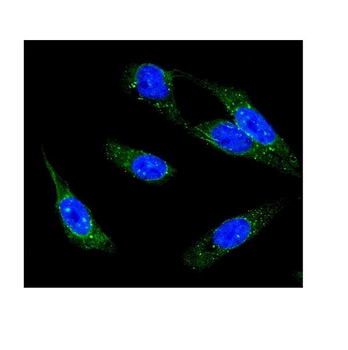IP3 receptor/ITPR1 Antibody