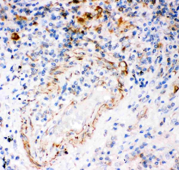 IP3 receptor/ITPR1 Antibody