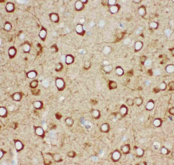 IP3 receptor/ITPR1 Antibody