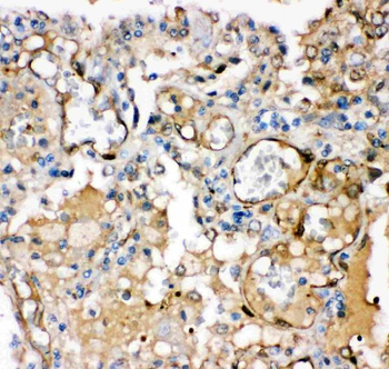 Maxi Potassium channel alpha/KCNMA1 Rabbit Polyclonal Antibody