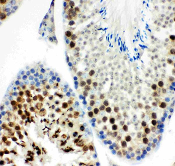 MCAK/KIF2C Rabbit Polyclonal Antibody