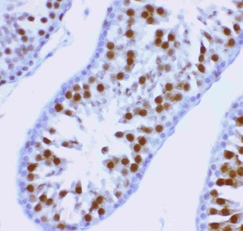 MCAK/KIF2C Rabbit Polyclonal Antibody
