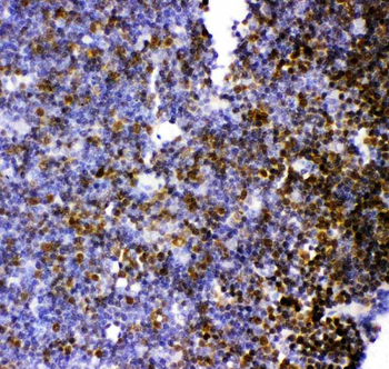 MCAK/KIF2C Rabbit Polyclonal Antibody