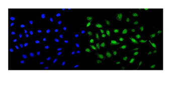 MCAK/KIF2C Rabbit Polyclonal Antibody