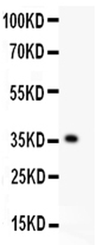 KLF6 Antibody