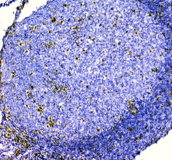 Smad Interacting Protein 1/ZEB2 Rabbit Polyclonal Antibody