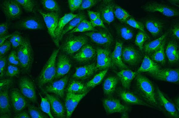 Hsp27/HSPB1 Antibody