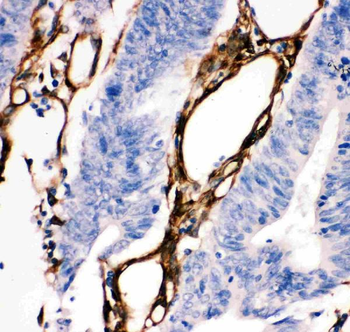 Hsp27/HSPB1 Antibody