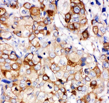 Hsp27/HSPB1 Antibody