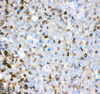 IL16 Rabbit Polyclonal Antibody