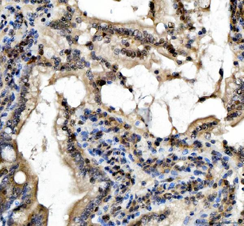 SLUG/SNAI2 Rabbit Polyclonal Antibody