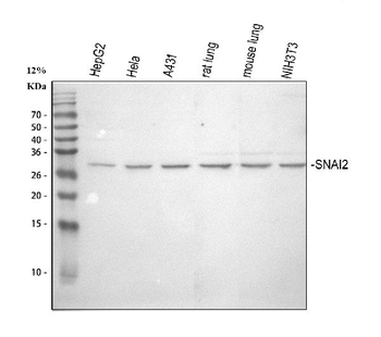 SLUG/SNAI2 Rabbit Polyclonal Antibody