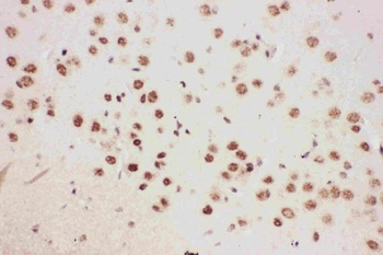 5 Lipoxygenase/ALOX5 Rabbit Polyclonal Antibody