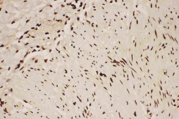 5 Lipoxygenase/ALOX5 Rabbit Polyclonal Antibody