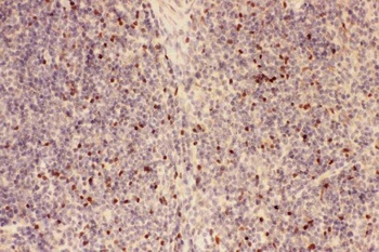 Forkhead box protein P3 FOXP3 Rabbit Polyclonal Antibody