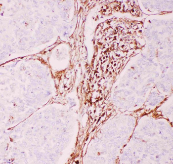 P Glycoprotein/ABCB1 Rabbit Polyclonal Antibody