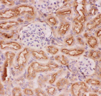P Glycoprotein/ABCB1 Rabbit Polyclonal Antibody