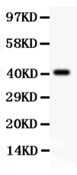 SCP3/SYCP3 Rabbit Polyclonal Antibody