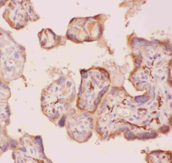 Angiopoietin 2/ANGPT2 Antibody