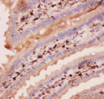 Angiopoietin 2/ANGPT2 Antibody