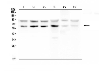 PD1/PDCD1 Rabbit Polyclonal Antibody