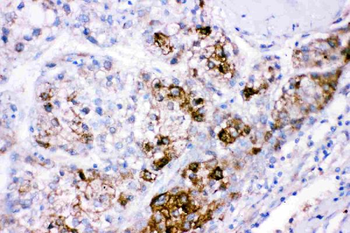 Cystathionine beta-synthase CBS Rabbit Polyclonal Antibody