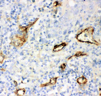 CD146/MCAM Rabbit Polyclonal Antibody