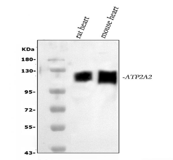 SERCA2 ATPase/ATP2A2 Rabbit Polyclonal Antibody