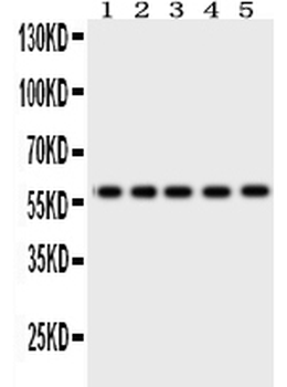 Occludin/OCLN Rabbit Polyclonal Antibody