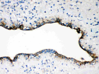 Occludin/OCLN Rabbit Polyclonal Antibody