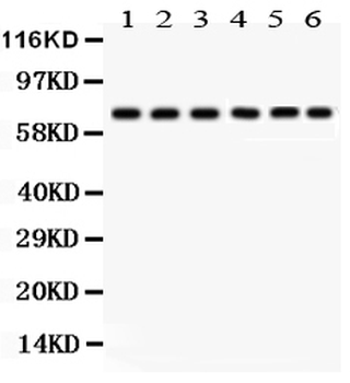 PKC delta/PRKCD Rabbit Polyclonal Antibody