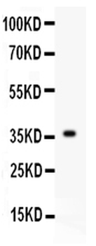 FGF1 Rabbit Polyclonal Antibody
