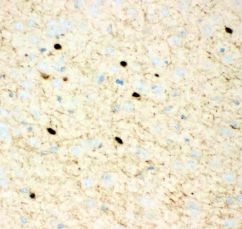 Calretinin/CALB2 Antibody