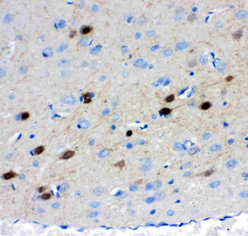 Calretinin/CALB2 Antibody