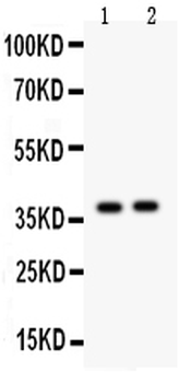 Calretinin/CALB2 Antibody