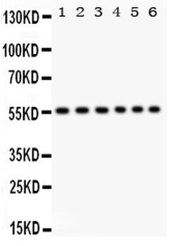 CD8 alpha/CD8A Rabbit Polyclonal Antibody