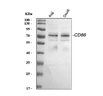 CD86 Rabbit Polyclonal Antibody