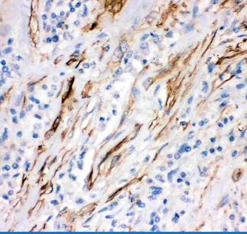 Fas Rabbit Polyclonal Antibody