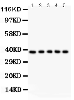 Fas Rabbit Polyclonal Antibody