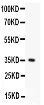 Fas Rabbit Polyclonal Antibody