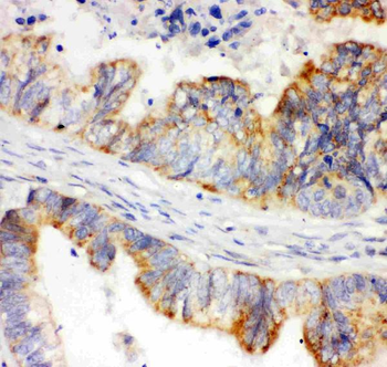 HIF-1-alpha/HIF1A/HIF Rabbit Polyclonal Antibody