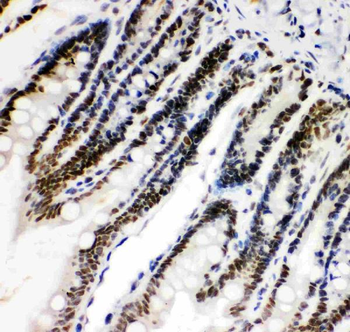 HIF-1-alpha/HIF1A/HIF Rabbit Polyclonal Antibody
