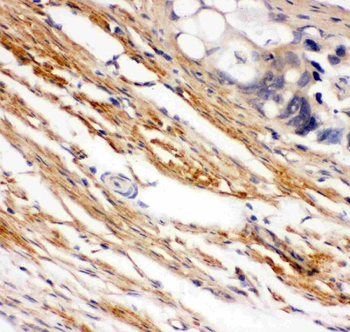 c-Kit Rabbit Polyclonal Antibody