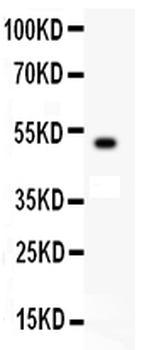 c-Kit Rabbit Polyclonal Antibody