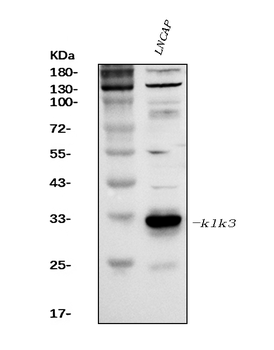 Prostate Specific Antigen/KLK3 Rabbit Polyclonal Antibody