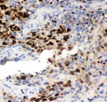 MCM7 Rabbit Polyclonal Antibody