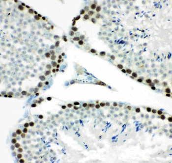 MCM7 Rabbit Polyclonal Antibody
