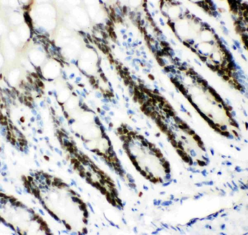 MCM7 Rabbit Polyclonal Antibody